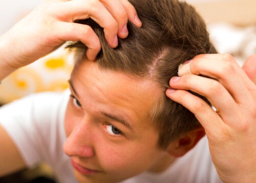 How to Prevent Juvenile Alopecia