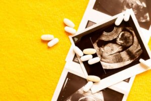 What is the Nuchal Fold Measurement?