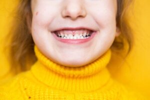 How to Prevent Malocclusions in Children