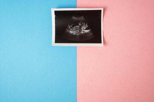 Knowing the Sex of Your Baby at the First Ultrasound: Is It possible?