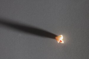 Premature Loss of a Baby Tooth: Causes and Consequences