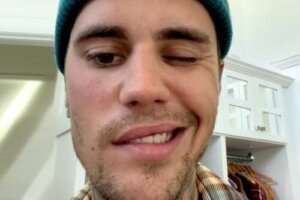 Ramsay Hunt Syndrome, the Condition that Justin Bieber Has