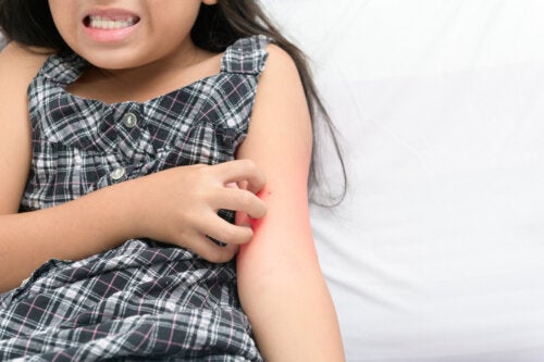 Dermatillomania in Children: What Is It?
