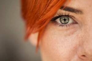 Freckles During Pregnancy: What You Should Know