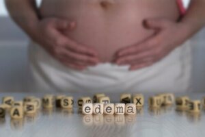 Swollen Hands During Pregnancy: Causes and Tips