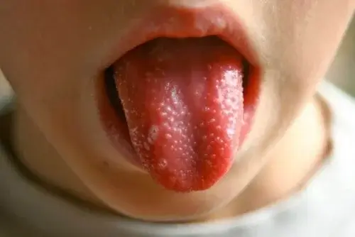A tongue with bumps.