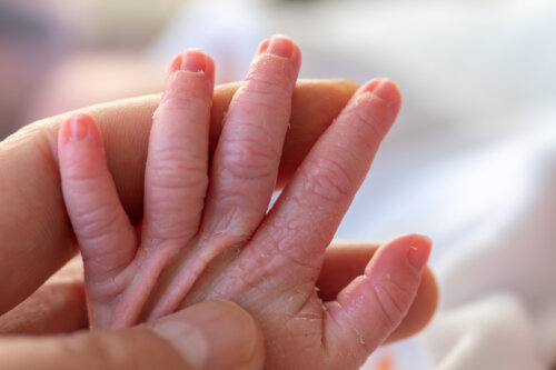 10 Recommendations for Caring for the Skin of Premature Babies