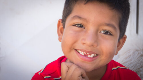 Dental Agenesis in Children: What You Should Know