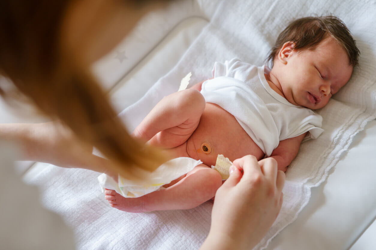 Oikeanlainen kotihoito synnytyksen jälkeen voi vähentää napatulehduksen riskiä.