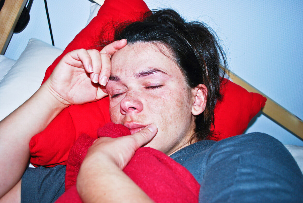 A sleeping woman with dark spots on her face.