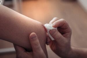 Abscesses in Children: Symptoms, Causes and Treatments