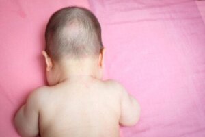 Why Does My Baby Have Bald Spots?
