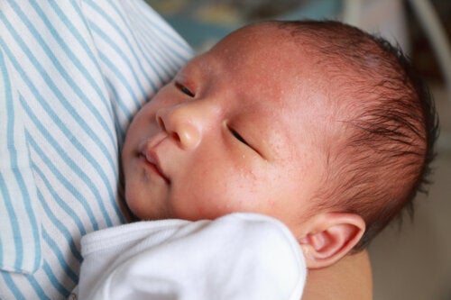 Milk Allergy in Infants: What You Should Know