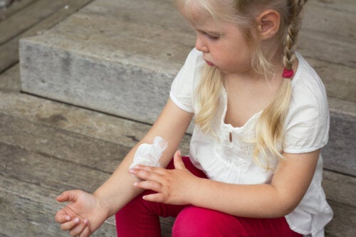10 Tips to Control Infantile Dermatitis