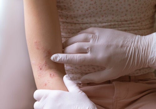The 10 Most Common Skin Problems in the First Year of Life