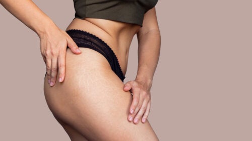 A Routine for Postpartum Stretch Marks