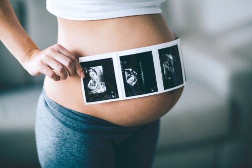 10 Questions About Ultrasounds During Pregnancy