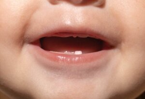 Your Child's First Dentist Appointment: What to Expect
