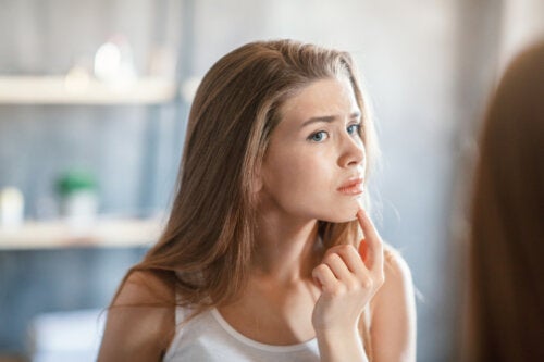 Is It Possible to Prevent Acne During Adolescence?