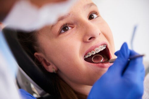 Early Orthodontics in Children: Expansion or Tooth Extractions?