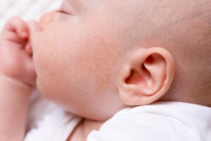 Pimples on a Baby's Face: Causes and Treatment