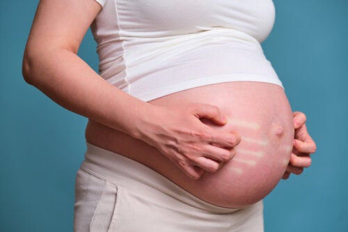 Skin Allergies During Pregnancy