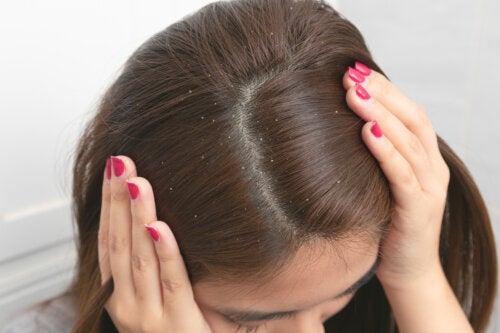 Dandruff During Pregnancy: Everything You Need to Know