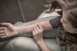 Self-Injury in Adolescents: How to Help