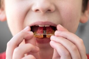 Pediatric Orthodontics: When to Begin?