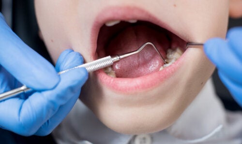 The 6 Most Common Dental Treatments for Children