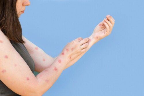 Everything You Need to Know About Monkeypox During Pregnancy