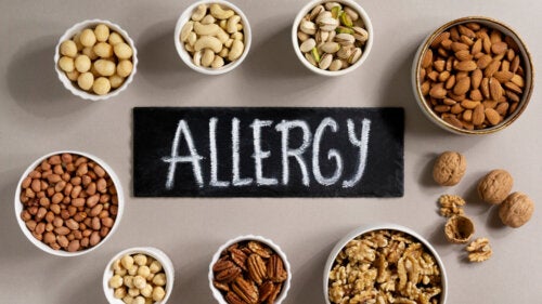 6 Myths About Food Allergies in Children