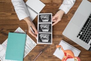 What is Triploidy or Triploid Syndrome?