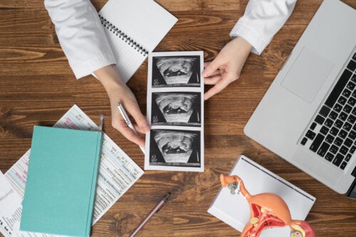 What is Triploidy or Triploid Syndrome?