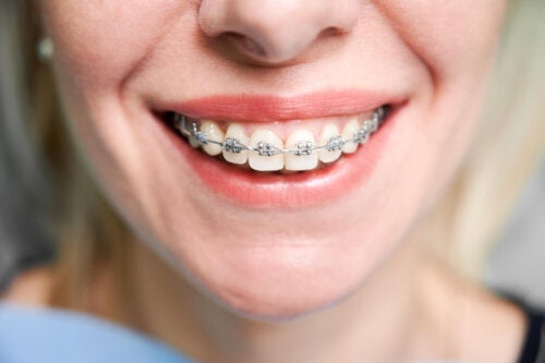 Is Orthodontics During Pregnancy Safe?